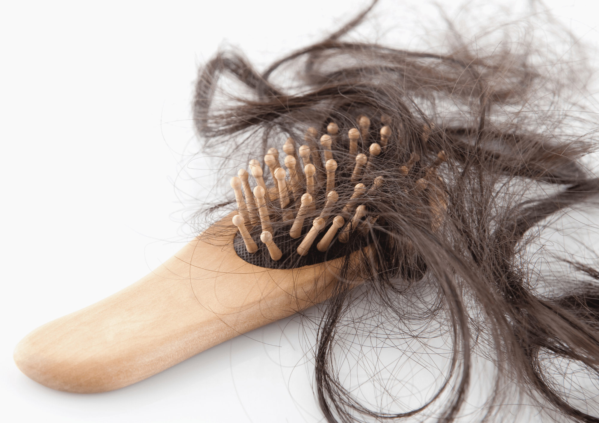 Hair Loss After Pregnancy: Treatment & Best Vitamins | Ecofeminist Mama