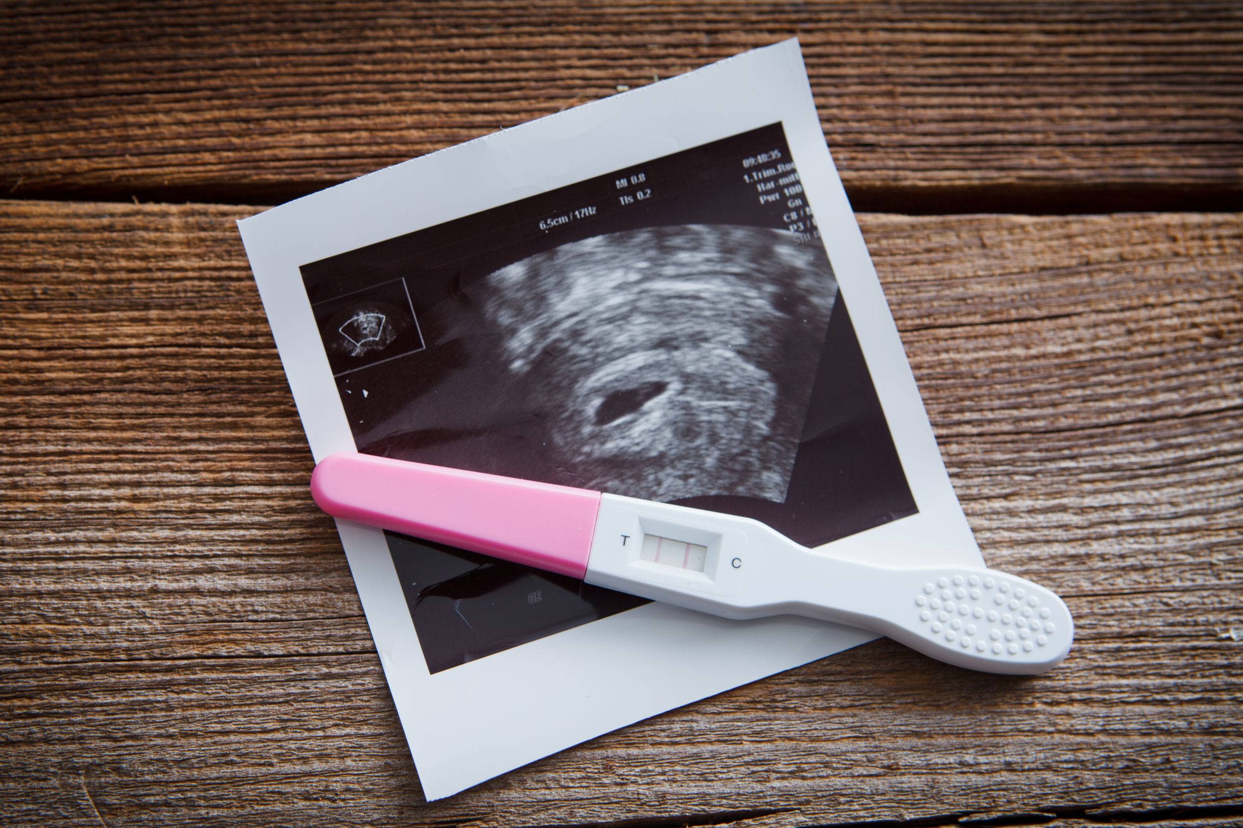 positive pregnancy test and sonogram